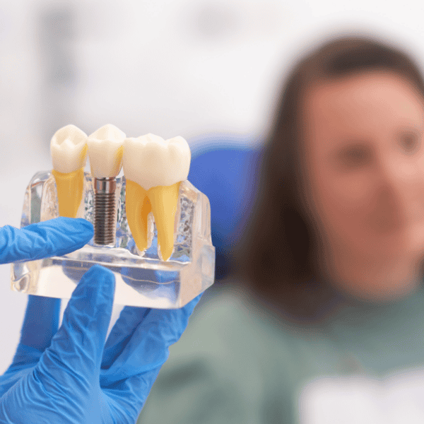 Teeth Replacement Image